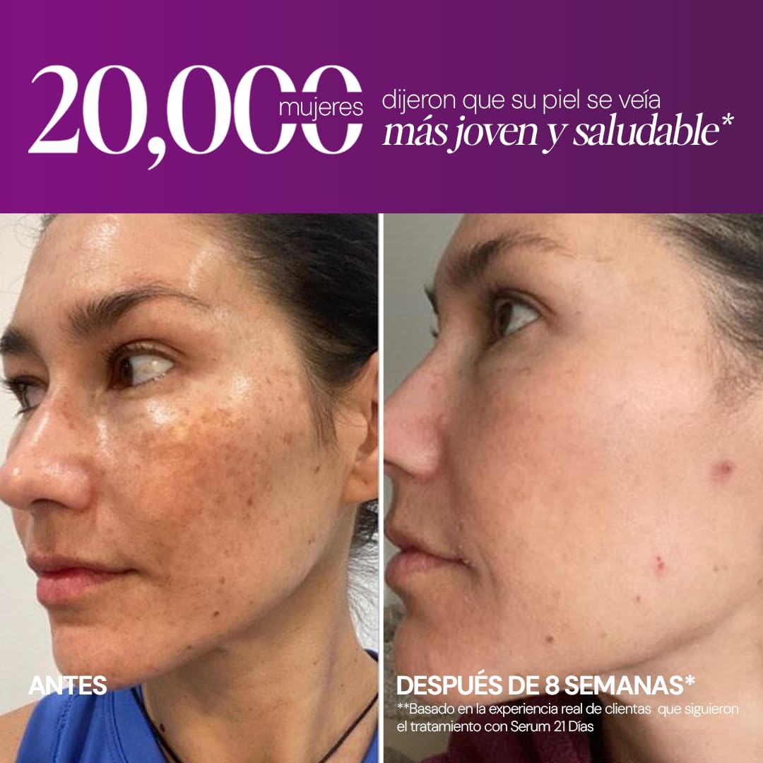 SEYOUL Suero Facial 21 Días con Ácido Hialurónico + Ácido Tranexámico + Niacinamida, Hidratación Profunda y Manchas Menos Visibles, 21 sobres