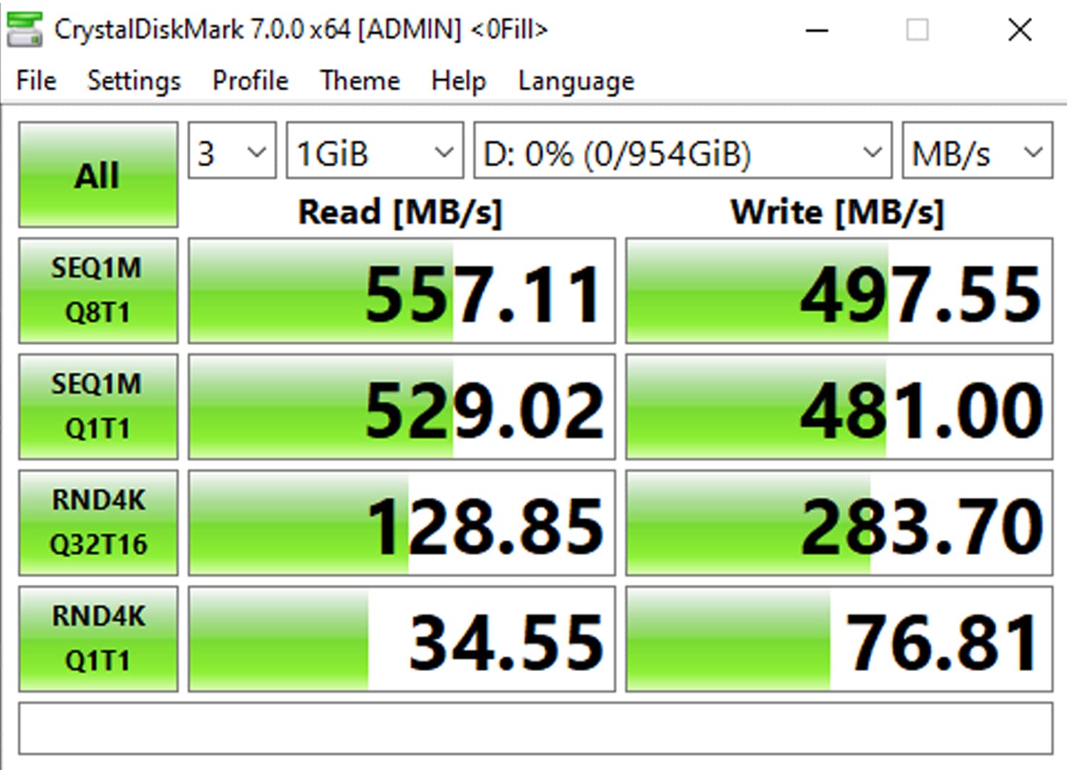 Timetec 1TB Unidad de estado sólido interna SSD 3D NAND SATA III 6Gb/s 2.5 pulgadas 7 mm (0.28 ") 800TBW Velocidad de lectura Hasta 550MB/s SLC Cache Performance Boost para PC computadora portátil y de escritorio (1TB)
