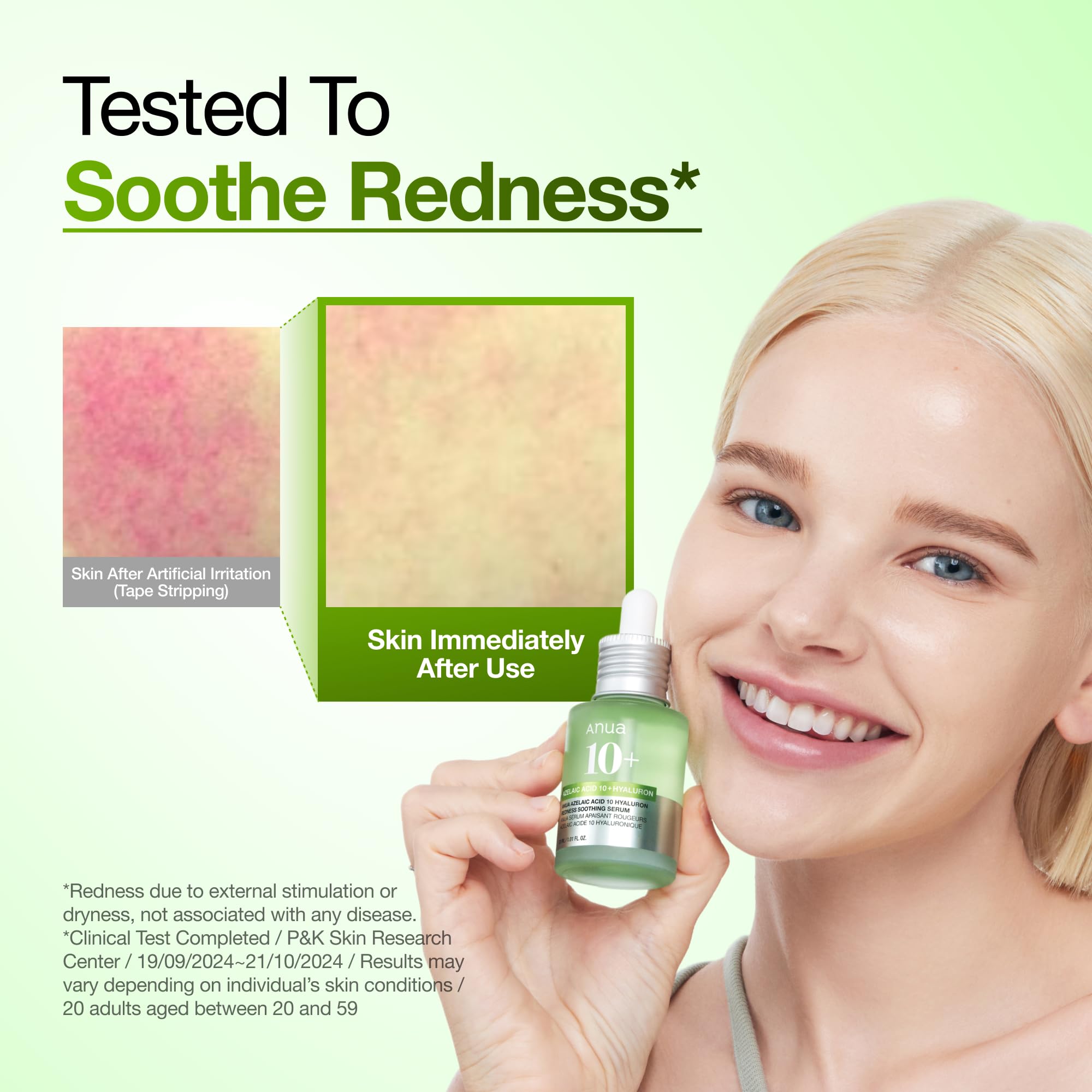 ANUA Azelaic Acid 10 Hyaluron Redness Soothing Serum, 30 ml