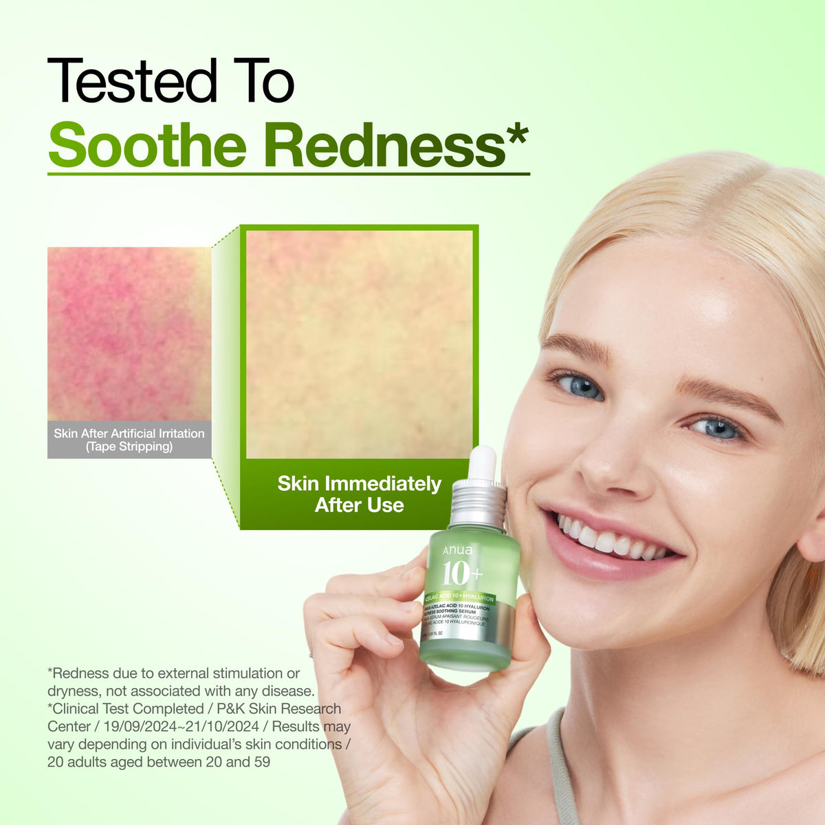 ANUA Azelaic Acid 10 Hyaluron Redness Soothing Serum, 30 ml