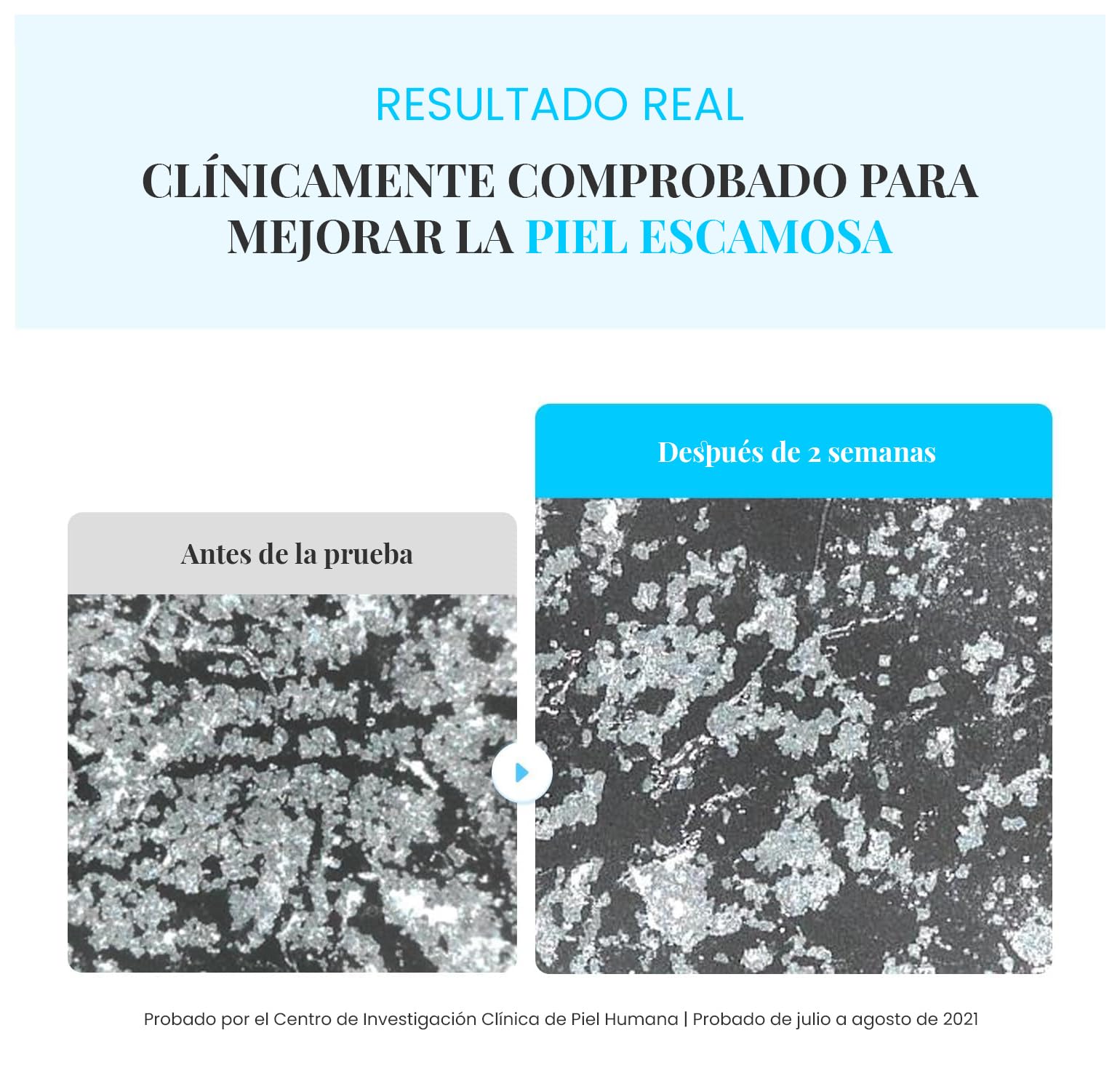 EQQUALBERRY Tónico Exfoliante Facial Swimming Pool Toner - Coreano con Enzima Proteasa y Ácido Hialurónico, Exfoliación Diaria Suave, Piel Sensible, 300 ml