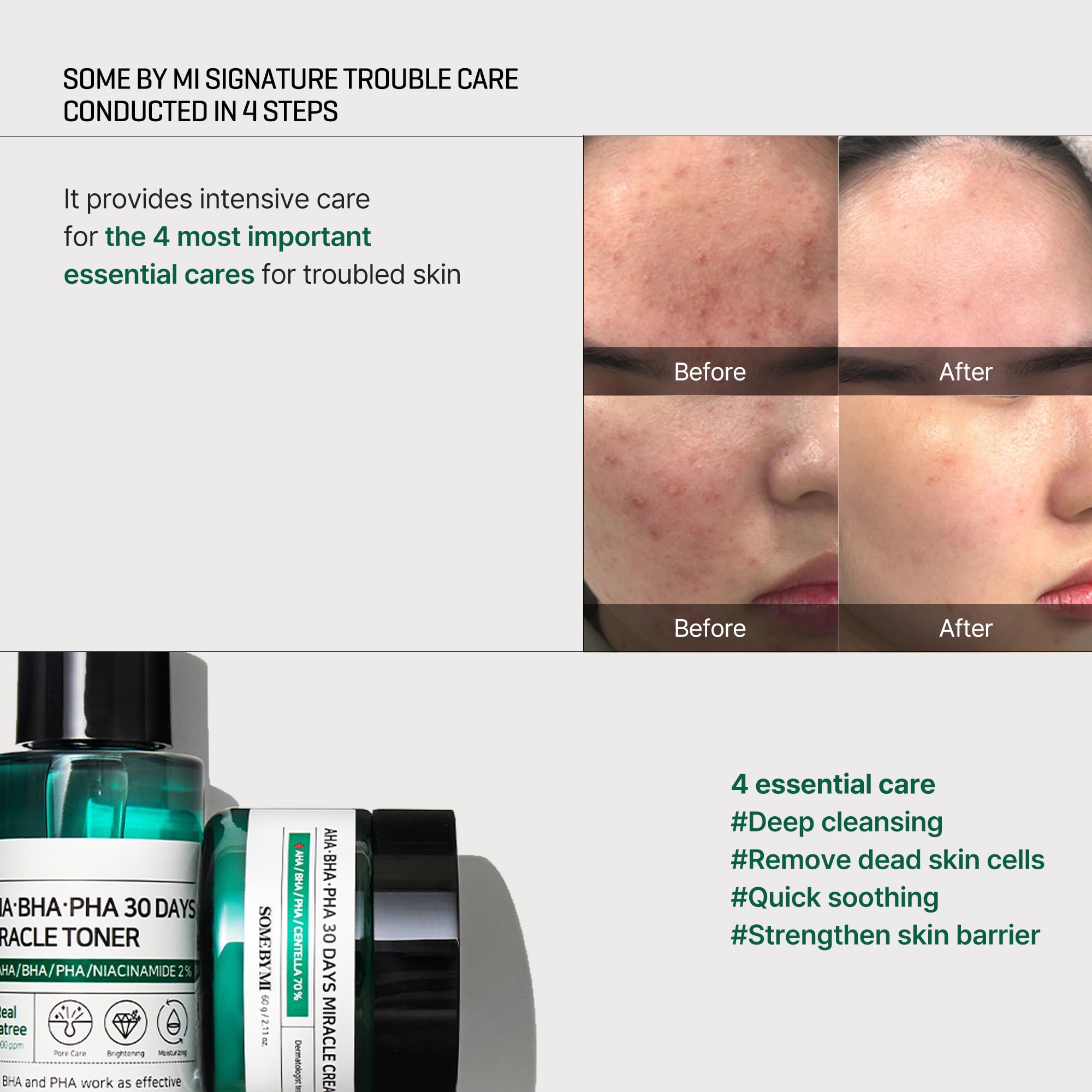 SOME BY MI AHA BHA PHA 30 Days Miracle Starter Kit, 4 Piezas
