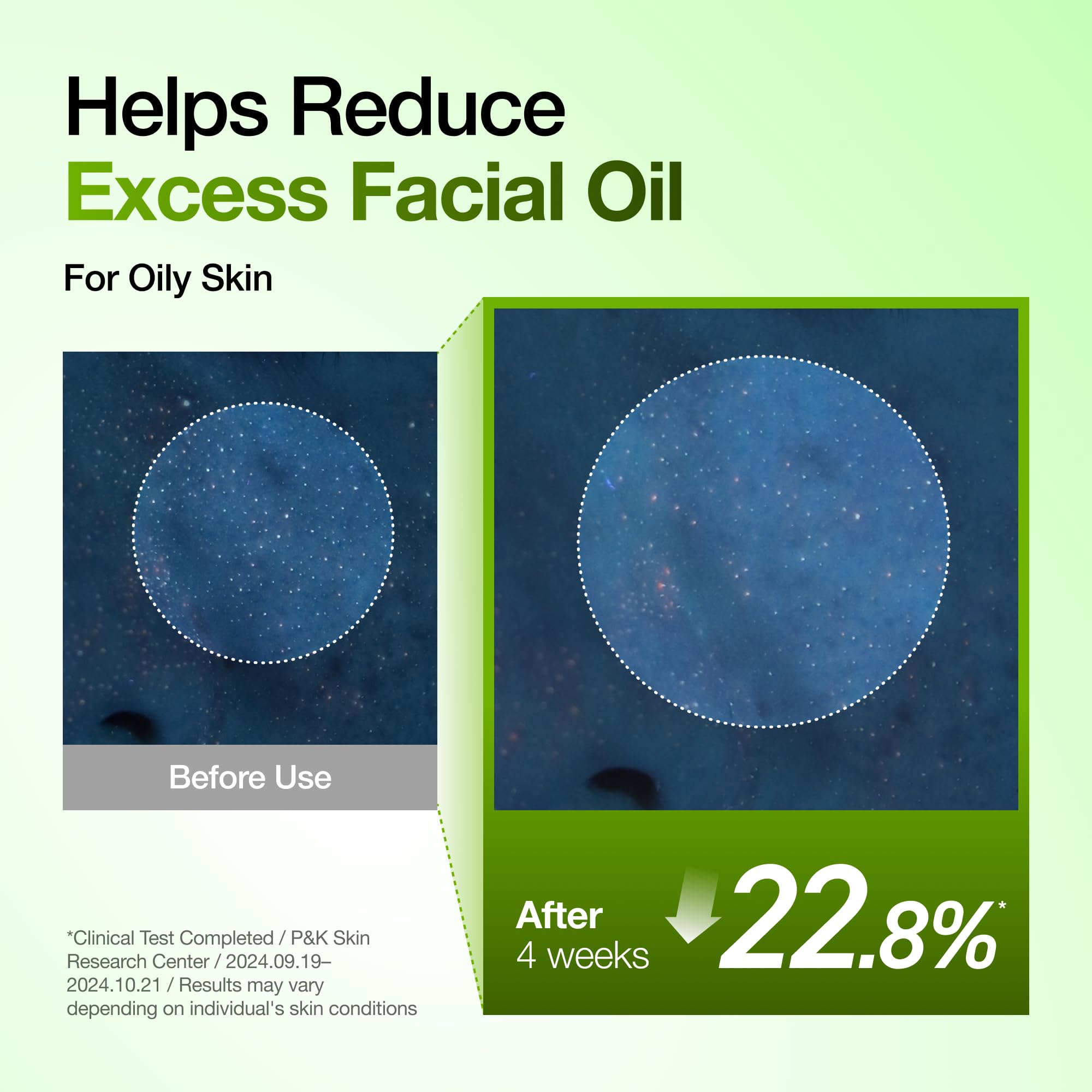 ANUA Azelaic Acid 10 Hyaluron Redness Soothing Serum, 30 ml