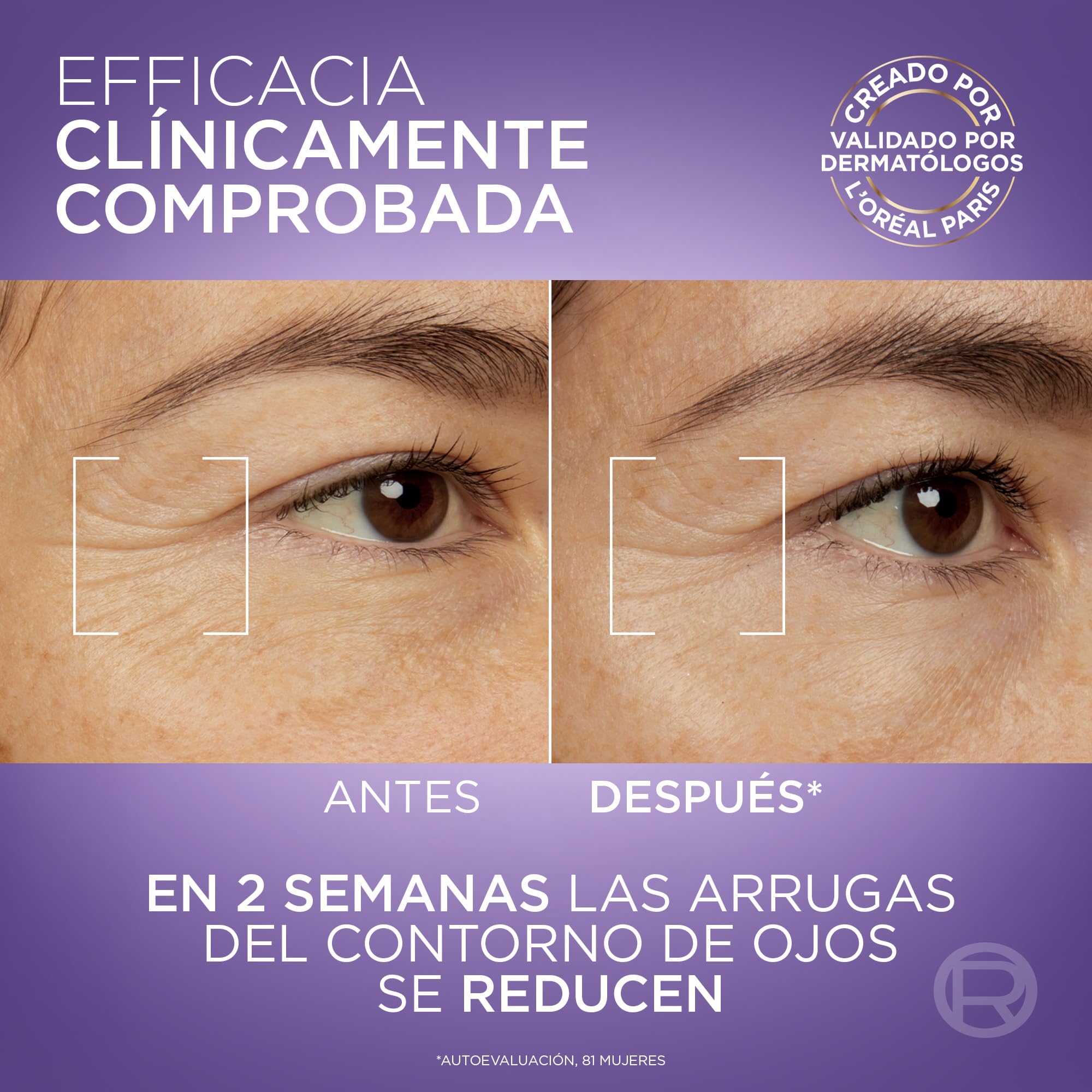 L'Oréal Paris Revitalift Filler Sérum de Ojos con Ácido Hialurónico + Cafeína, Rellena hasta 2.5% Líneas de Expresión y Corrige Ojeras, Aplicador Triple Perla, 15 ml
