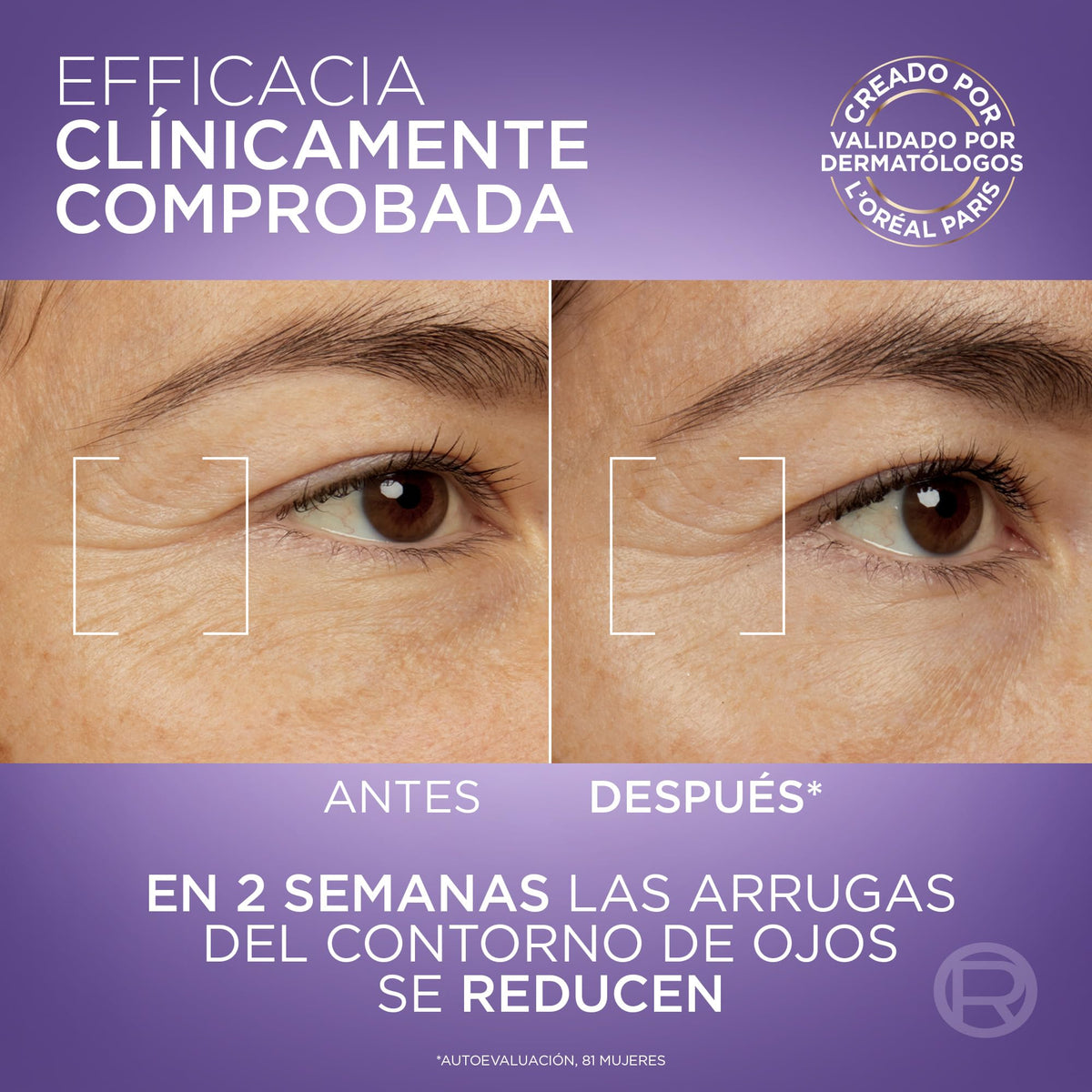 L'Oréal Paris Revitalift Filler Sérum de Ojos con Ácido Hialurónico + Cafeína, Rellena hasta 2.5% Líneas de Expresión y Corrige Ojeras, Aplicador Triple Perla, 15 ml