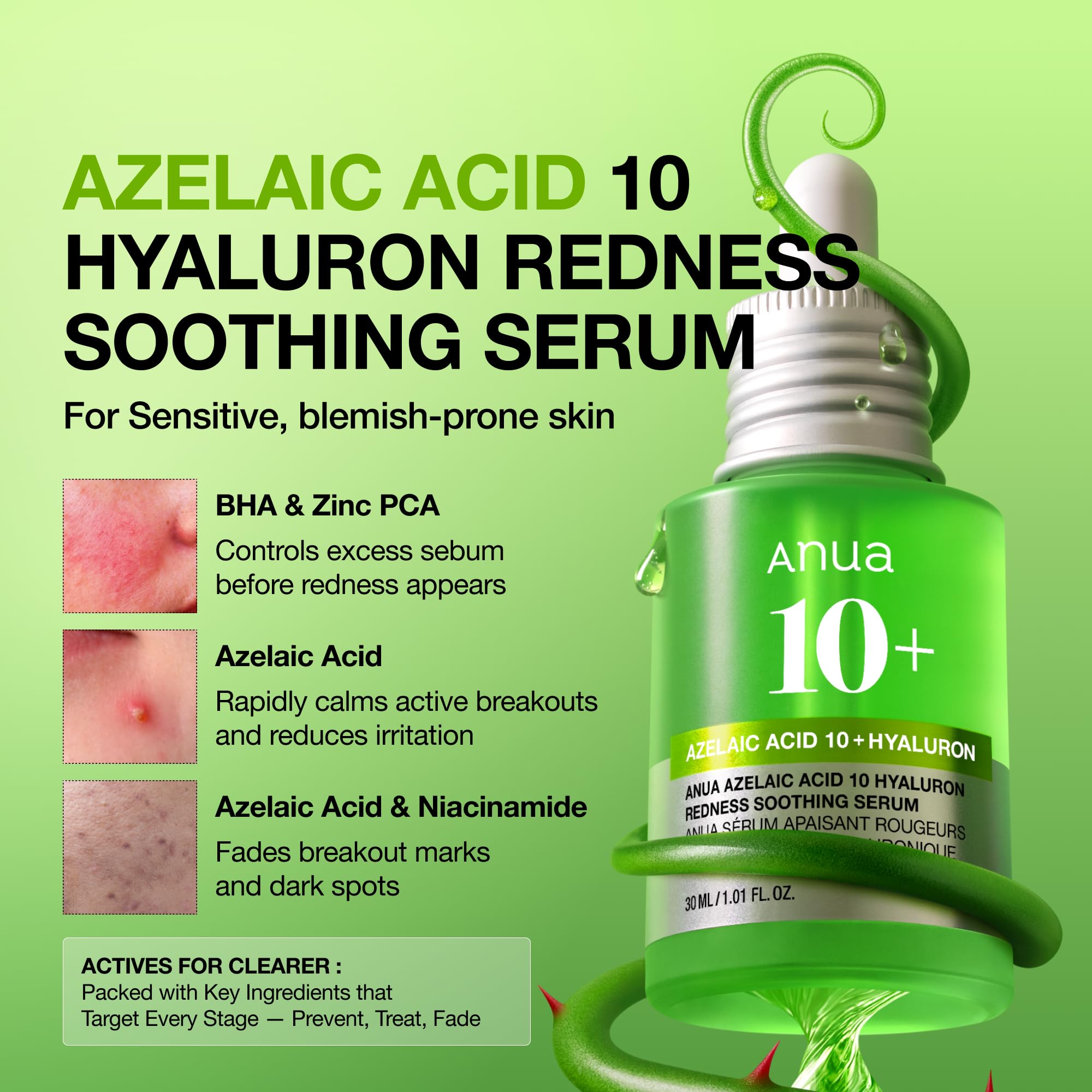 ANUA Azelaic Acid 10 Hyaluron Redness Soothing Serum, 30 ml