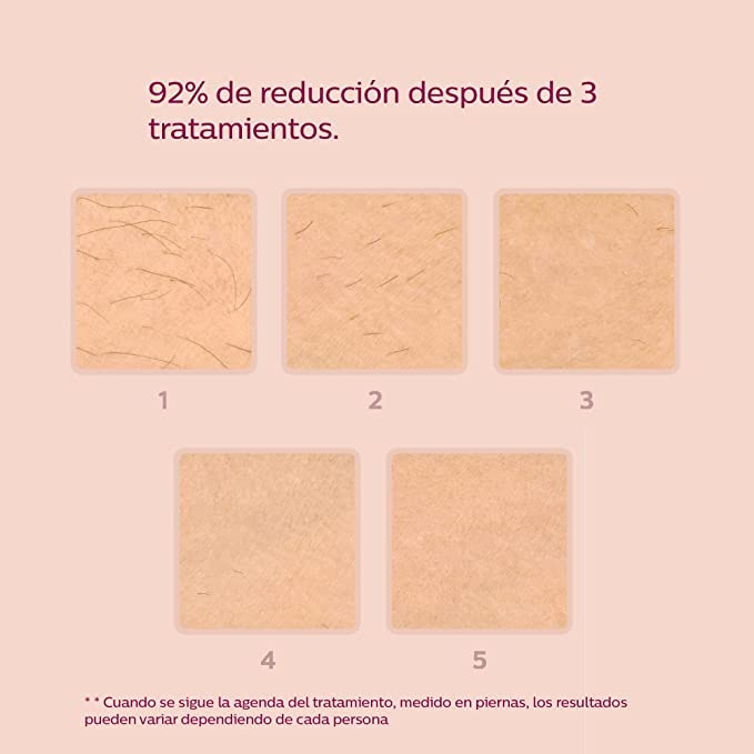 Philips Lumea Prestige Depiladora IPL, Tecnología Sense IQ, Luz Pulsada, con cable, 4 Cabezales Inteligentes (Cuerpo, Bikini, Axilas y Cara) y SmartSkin Sensor, incluye un Recortador Precisión